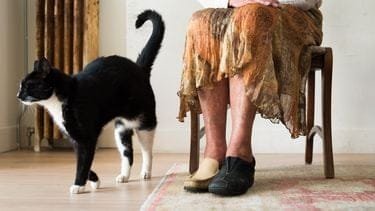 Slimme hersenstimulatie geeft nieuwe hoop aan mensen met Parkinson