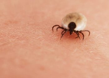 Check your bits: uptick in tick bites as season starts