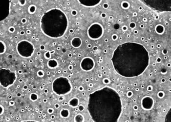 New prostate cancer treatment improves quality of life