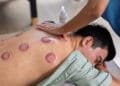 ‘Wet cupping’ mag niet zomaar zonder arts gebeuren, maar bijna alle aanbieders doen dat toch, ziet inspectie
