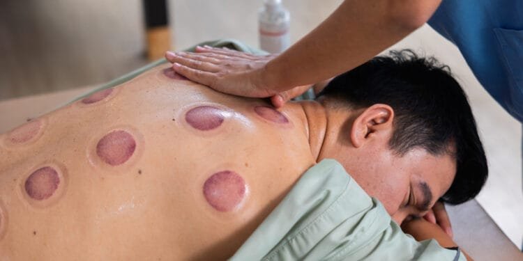 ‘Wet cupping’ mag niet zomaar zonder arts gebeuren, maar bijna alle aanbieders doen dat toch, ziet inspectie