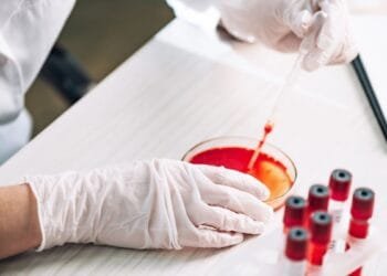 Utrecht death shows West Nile virus is circulating in NL