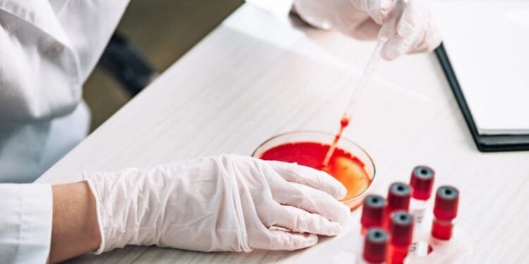 Utrecht death shows West Nile virus is circulating in NL
