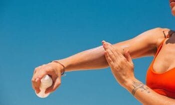 huidkanker treft mannen en vrouwen vaak op andere plekken